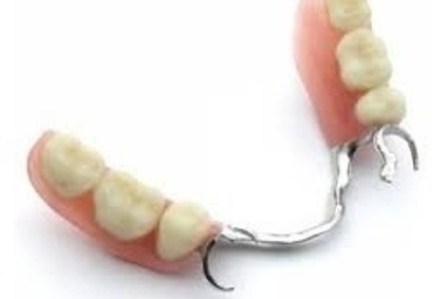 Parcijalne skeletirane vizil proteze