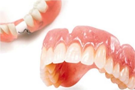 Silikonske parcijalne proteze