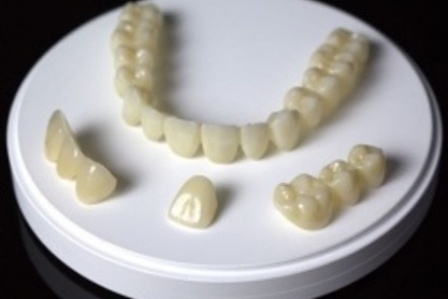 Bezmetalne krunice i mostovi