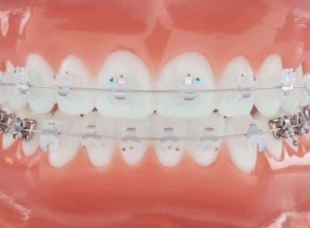 SAMOLIGIRAJUĆE SAFIRNE (PROVIDNE) BRAVICE cena SAMOLIGIRAJUĆE SAFIRNE (PROVIDNE) BRAVICE cena