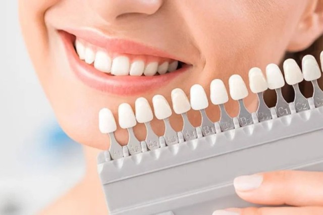 Zašto odabrati Extra Dental Beograd?