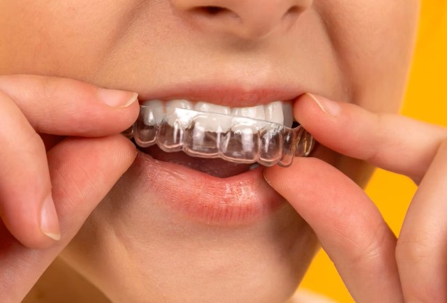 Folije za ispravljanje zuba