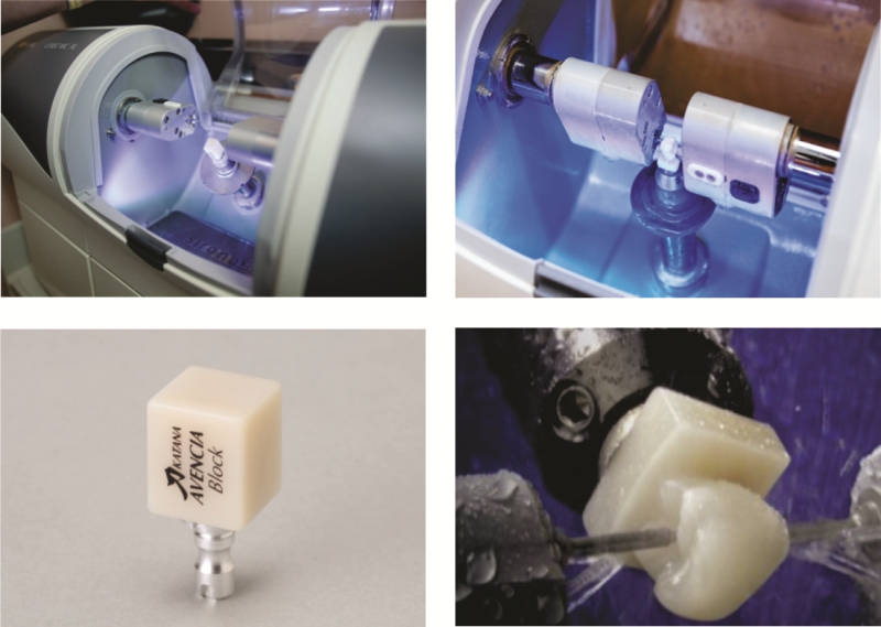 Zašto izabrati Extra Dental zubotehničku laboratoriju?