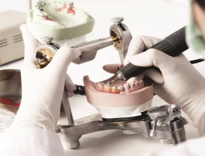 Bezmetalne krunice i mostovi