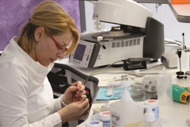 Bezmetalne krunice i mostovi