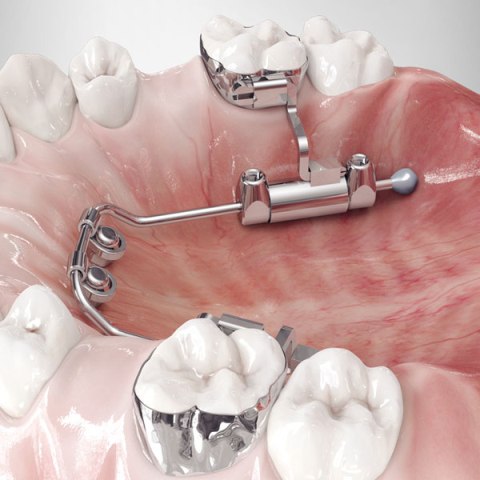 Ortopedija vilica – dijagnostika i ispravljanje nepravilnosti