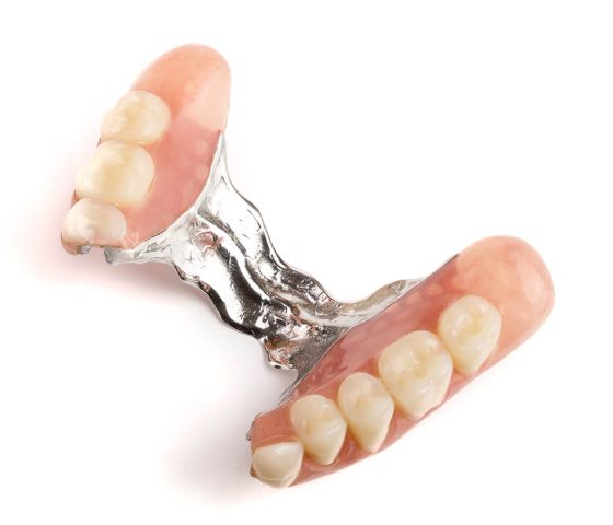 Parcijalne zubne proteze