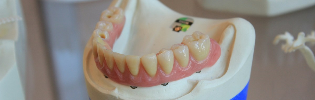 Totalne proteze | Extra Dental Beograd