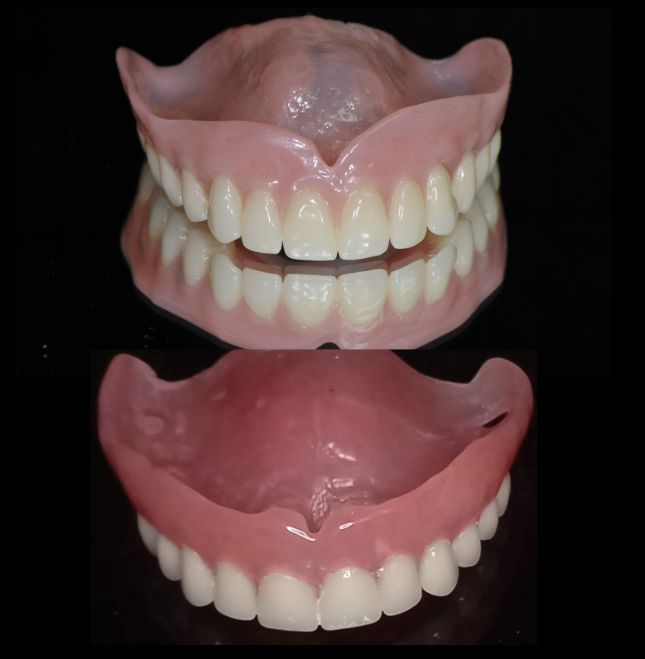 Period privikavanja na protezu