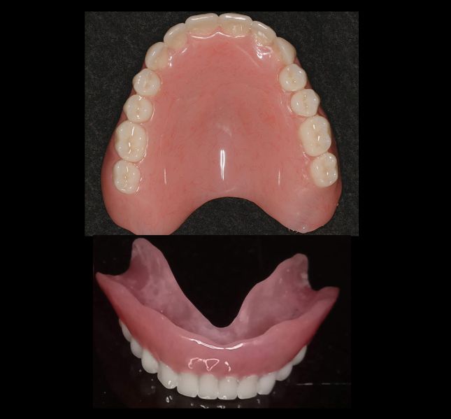 Održavanje i trajnost proteze